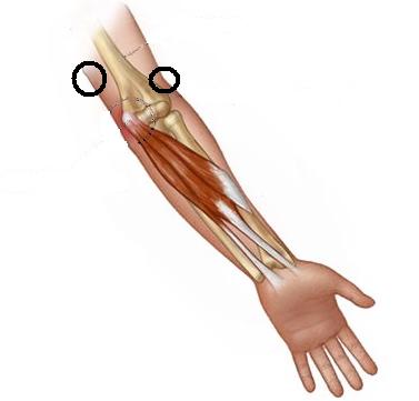 Barry's elbow pain location anatomy graphic