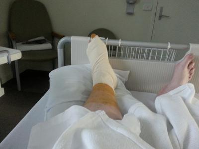 Woke Up After Toe Tumor Surgery & Could Not feel My Foot
