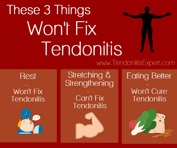 3 Things Won't Fix Tendonitis