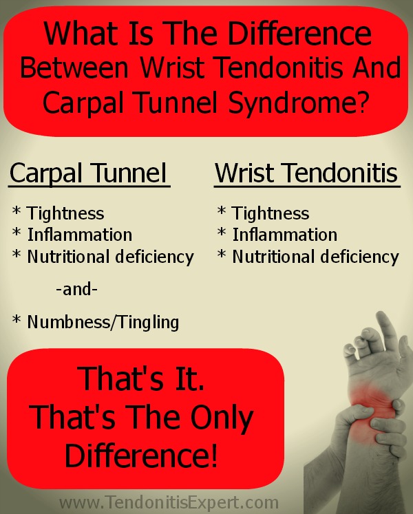 Carpal tunnel guitar reddit discount