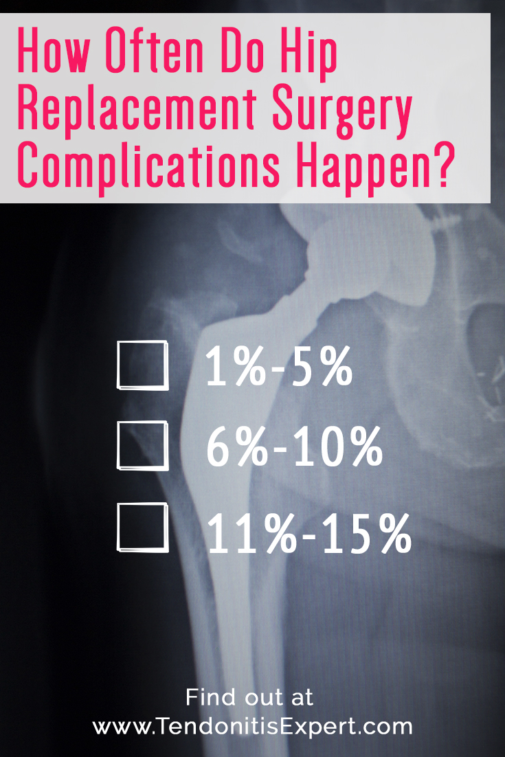 How Often Do Hip Replacement Surgery Complications Happen?

- 1%-5%
- 6%-10%
- 11%-15%


Find out at www.TendonitisExpert.com/hip-replacement-surgery.html