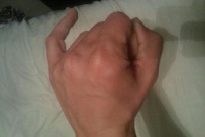 Pinky clearance finger guitar