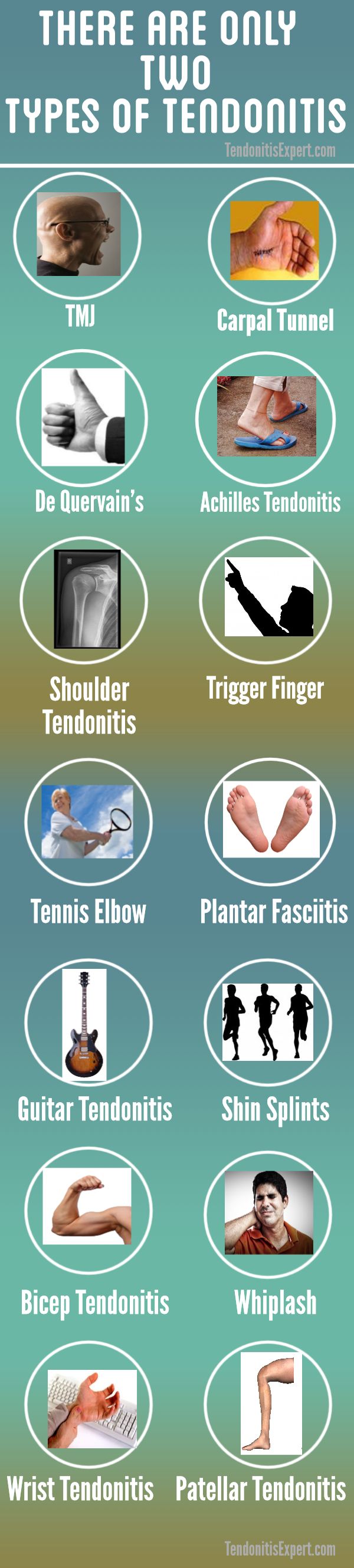 tendonitis types infographic