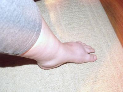 Best Recovery Sandals For Plantar Fasciitis - Best Running Shoes for Plantar Fasciitis (July 2019) - Top / Wendy bumgardner is a freelance writer covering walking and other health and fitness.