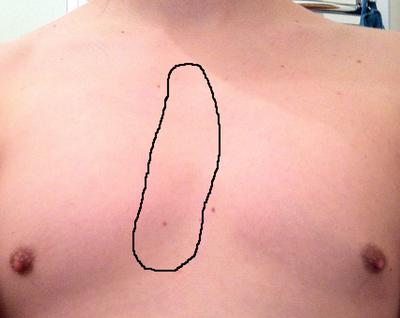Area where it hurts the most is marked with a black circle