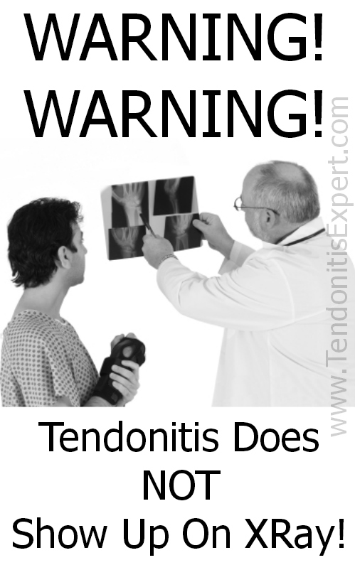 tendonitis does not show up on xray