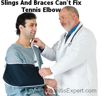 Tennis elbow brace and slings can't fix Tennis Elbow