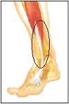 pain at front lateral side of lower leg