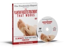 Plantar fasciitis Treatment That Works dvd cover