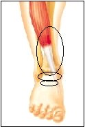 pain at top front of ankle