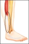 pain at back lateral side of lower leg