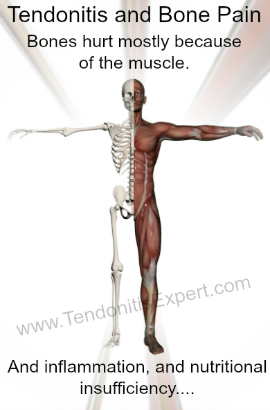 Tendonitis And Bone Pain