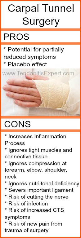 Pros and Cons of Carpal Tunnel Surgery