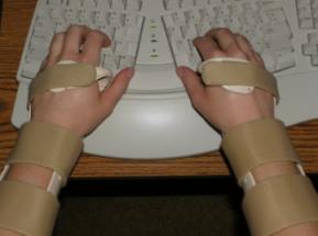 ergonomic keyboard and wrist splints